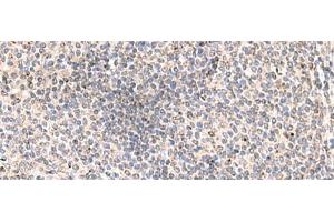 Immunohistochemistry of paraffin-embedded Human tonsil tissue using MLKL Polyclonal Antibody at dilution of 1:85(x200) (MLKL antibody)