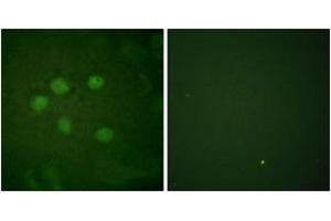 Immunofluorescence analysis of HuvEc cells, using AOS1 Antibody. (SAE1 antibody  (AA 221-270))