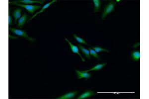 Immunofluorescence of purified MaxPab antibody to ELP3 on HeLa cell. (ELP3/KAT9 antibody  (AA 1-547))