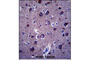 P Antibody (Center) 13689c immunohistochemistry analysis in formalin fixed and paraffin embedded human brain tissue followed by peroxidase conjugation of the secondary antibody and DAB staining. (APP antibody  (AA 333-362))