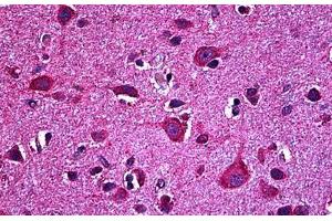 Human Brain, Cortex: Formalin-Fixed, Paraffin-Embedded (FFPE) (EPH Receptor B6 antibody  (AA 23-122))