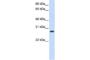 HSD11B1 antibody used at 1 ug/ml to detect target protein. (HSD11B1 antibody)