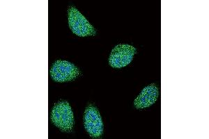 Confocal immunofluorescent analysis of SERPINA6 Antibody (Center) (ABIN654693 and ABIN2844385) with 293 cell followed by Alexa Fluor 488-conjugated goat anti-rabbit lgG (green). (SERPINA6 antibody  (AA 197-225))