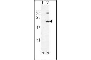 Western blot analysis of IL17F (arrow) using rabbit polyclonal IL17F Antibody (N-term) (ABIN654914 and ABIN2844560).
