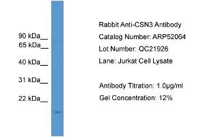 WB Suggested Anti-CSN3  Antibody Titration: 0. (CSN3 antibody  (N-Term))