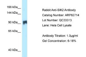 Western Blotting (WB) image for anti-Salt-Inducible Kinase 2 (SIK2) (N-Term) antibody (ABIN2789222) (SIK2 antibody  (N-Term))
