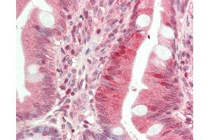 Anti-HDAC9 antibody IHC staining of human small intestine. (HDAC9 antibody  (Internal Region))