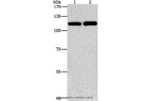 Western blot analysis of Raji and K562 cell, using TLR3 Polyclonal Antibody at dilution of 1:500 (TLR3 antibody)