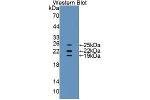 WB of Protein Standard: different control antibodies  against Highly purified E. (Catalase ELISA Kit)