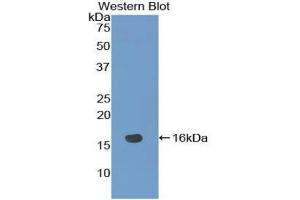 Detection of Recombinant NRARP, Mouse using Polyclonal Antibody to Notch Regulated Ankyrin Repeat Protein (NRARP)