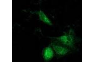 Anti-ACAT2 mouse monoclonal antibody (ABIN2453825) immunofluorescent staining of COS7 cells transiently transfected by pCMV6-ENTRY ACAT2 (RC201821). (ACAT2 antibody)