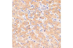 Immunohistochemistry of paraffin-embedded human liver using PDCD2L antibody (ABIN6130653, ABIN6145336, ABIN6145337 and ABIN6223261) at dilution of 1:100 (40x lens). (PDCD2L antibody  (AA 1-358))