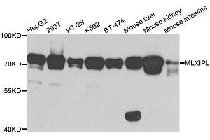 Western blot analysis of extracts of various cell lines, using MLXIPL antibody. (MLXIPL antibody  (AA 17-175))