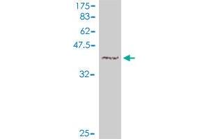 Western Blot detection against Immunogen (37. (ATM antibody  (AA 1-100))