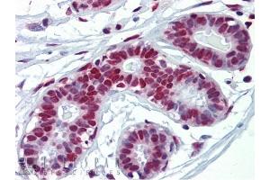 FUS antibody was used for immunohistochemistry at a concentration of 5. (FUS antibody  (N-Term))