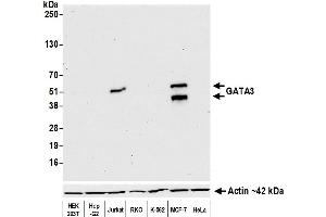 Western Blotting (WB) image for anti-GATA Binding Protein 3 (GATA3) (AA 150-200) antibody (ABIN7455153) (Recombinant GATA3 antibody  (AA 150-200))