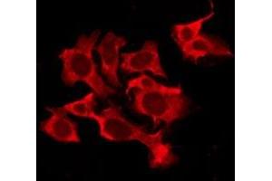 ABIN6276209 staining Hela by IF/ICC. (QRFPR antibody  (Internal Region))