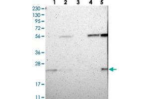 Western blot analysis of Lane 1: RT-4, Lane 2: U-251 MG, Lane 3: Human Plasma, Lane 4: Liver, Lane 5: Tonsil with FAM213B polyclonal antibody . (C1orf93 antibody)