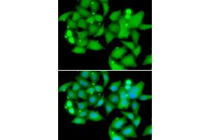 Immunofluorescence analysis of A549 cells using UBASH3B antibody (ABIN5974296). (UBASH3B antibody)