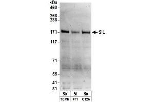anti-SCL/TAL1 Interrupting Locus (STIL) (AA 1237-1287) antibody