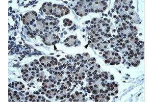 Image no. 1 for anti-Transmembrane Phosphatase with Tensin Homology (TPTE) (AA 461-510) antibody (ABIN202467) (TPTE antibody  (AA 461-510))