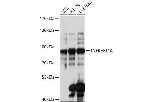 Western blot analysis of extracts of various cell lines, using TNFRSF11A antibody (ABIN6127589, ABIN6149310, ABIN6149312 and ABIN6217357) at 1:3000 dilution. (TNFRSF11A antibody  (AA 466-616))