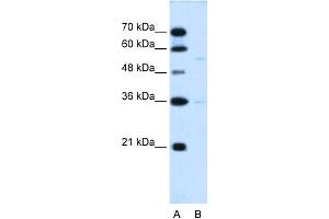 WB Suggested Anti-C19orf28 Antibody Titration:  0. (C19orf28 antibody  (Middle Region))