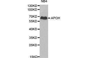 Western blot analysis of NB4 cell lysate using APOH antibody. (APOH antibody  (AA 21-345))
