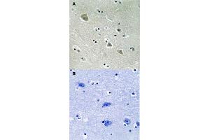 Immunohistochemical staining of human brain tissue by PAK1 (phospho S204) polyclonal antibody  without blocking peptide (A) or preincubated with blocking peptide (B) under 1:50-1:100 dilution. (PAK1 antibody  (pSer204))
