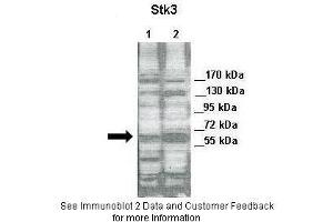 Lanes:   Lane 1: 30ug of HeLa cell lysate Lane 2: 30ug of 293T cell lysate  Primary Antibody Dilution:   1:2000  Secondary Antibody:   Anti-rabbit-HRP  Secondary Antibody Dilution:   1:5000  Gene Name:   STK3  Submitted by:   Jixin Dong & Yuanhong Chen,University of Nebraska (STK3 antibody  (N-Term))
