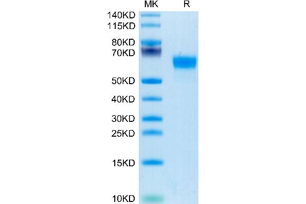 Complement Factor H Protein (CFH) (AA 860-1231) (His tag)