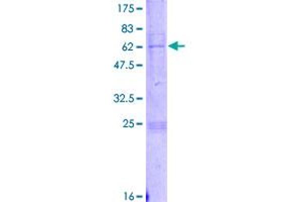 PDSS1 Protein (AA 1-306) (GST tag)