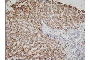 Human liver tissue was initrocelluloseubated with anti-human Ak3 (1:100) for 2 hours at room temperature. (Adenylate Kinase 3 antibody)