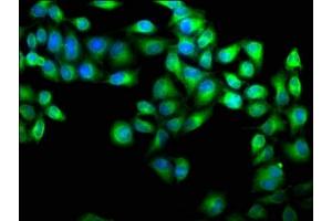 Immunofluorescence staining of Hela cells with ABIN7146372 at 1:100, counter-stained with DAPI. (CAB39 antibody  (AA 28-290))