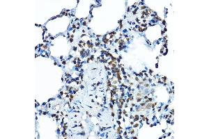 Immunohistochemistry of paraffin-embedded rat lung using BOP1 Rabbit pAb (ABIN7265887) at dilution of 1:100 (40x lens). (BOP1 antibody  (AA 600-680))
