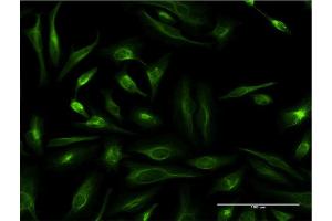 Immunofluorescence of monoclonal antibody to TAGLN on HeLa cell. (Transgelin antibody  (AA 1-201))