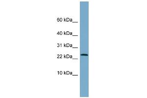 WB Suggested Anti-LRRC20 Antibody Titration: 0. (LRRC20 antibody  (Middle Region))