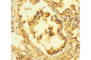 Immunohistochemistry of paraffin-embedded human lung tissue using ABIN7164777 at dilution of 1:100 (LEPREL1 antibody  (AA 301-528))