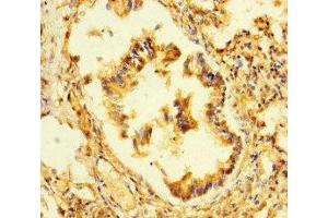 Immunohistochemistry of paraffin-embedded human lung tissue using ABIN7164777 at dilution of 1:100