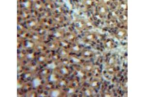 Used in DAB staining on fromalin fixed paraffin-embedded Kidney tissue (IL12B antibody  (AA 35-302))