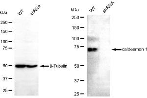 Western blotting analysis using caldesmon 1 antibody (ABIN7797840).