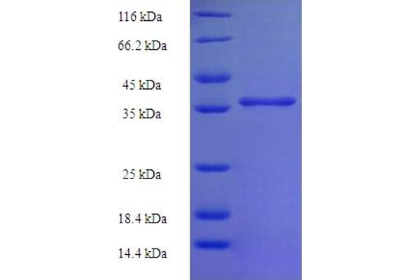 C11orf73 Protein (AA 1-197, full length) (His-SUMO Tag)