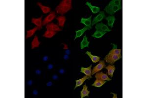 ABIN6262783 and ABIN6266573 staining HepG2 cells by IF/ICC. (KRT20 antibody  (C-Term))
