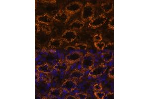 Immunofluorescence analysis of rat kidney using SLC7 antibody (ABIN6130697, ABIN6148048, ABIN6148049 and ABIN6216625) at dilution of 1:100. (SLC7A9 antibody  (AA 1-100))