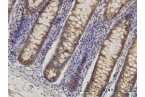 Immunoperoxidase of monoclonal antibody to HADHSC on formalin-fixed paraffin-embedded human colon. (HADH antibody  (AA 205-314))