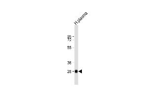 Anti-CFD Antibody (N-term) at 1:2000 dilution + human plasma lysate Lysates/proteins at 20 μg per lane. (Adipsin antibody  (N-Term))