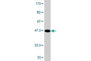 Western Blot detection against Immunogen (47. (MYL3/CMLC1 antibody  (AA 1-195))