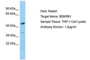 Image no. 1 for anti-Bradykinin Receptor B1 (BDKRB1) (AA 230-279) antibody (ABIN6749995) (BDKRB1 antibody  (AA 230-279))