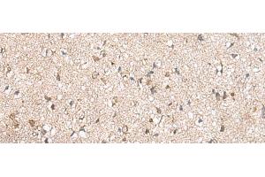 Immunohistochemistry of paraffin-embedded Human brain tissue using RPL23A Polyclonal Antibody at dilution of 1:50(x200) (RPL23A antibody)