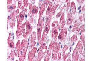 Immunohistochemistry (IHC) image for anti-Sodium Channel, Nonvoltage-Gated 1, beta (SCNN1B) (C-Term) antibody (ABIN6736428)